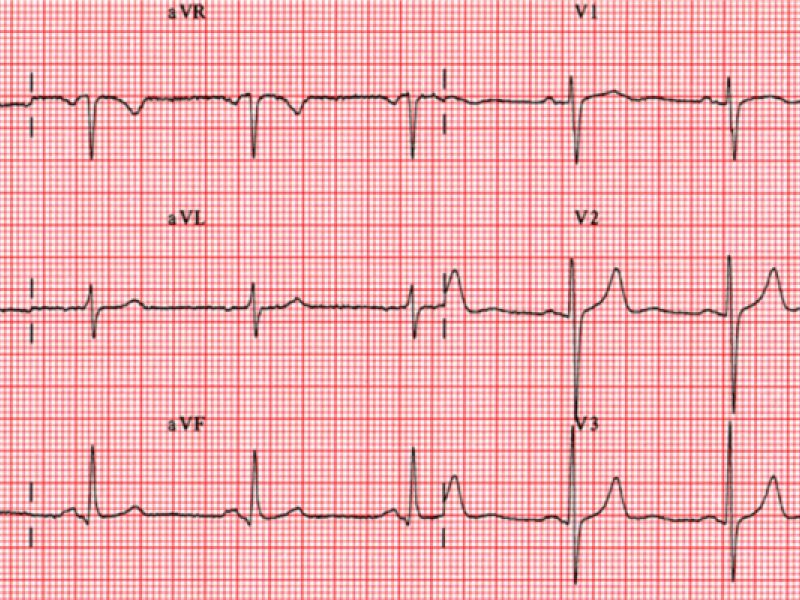 Nuova normativa certificati medici